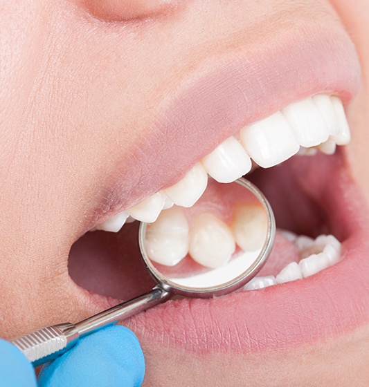 Dentist checking patient's metal free dental restoration