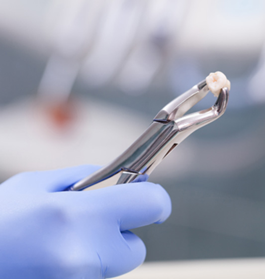Dental forceps gripping an extracted tooth 