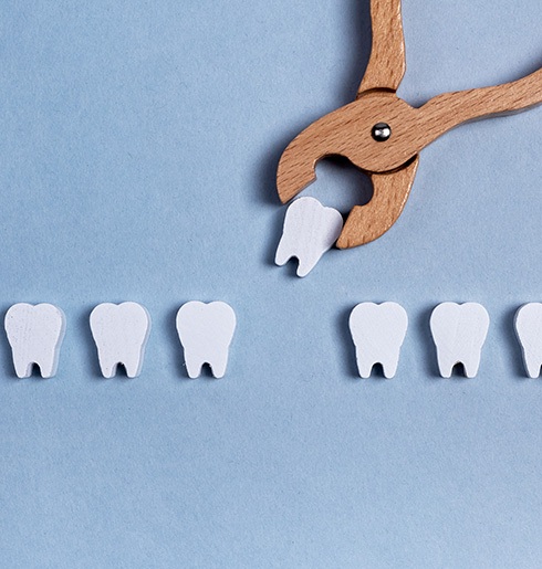 The cost of tooth extraction can vary from patient to patient