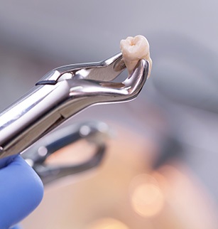 Other options for making tooth extractions more affordable include flexible financing